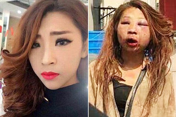 Cô gái trẻ mặt biến dạng vì bị vợ nhân tình đánh ghen dich-vu-tham-tu-sai-gon-danh-ghen-chong-ngoai-tinh